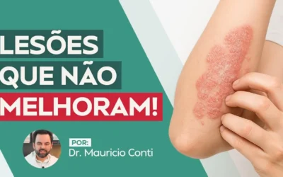 Como saber se eu tenho Psoríase? Diagnósticos e Sintomas que Você Não Pode Ignorar