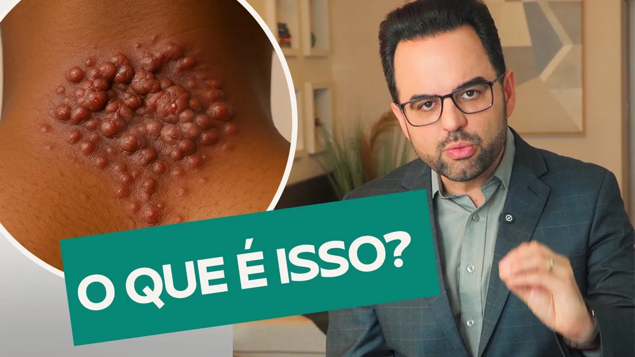 Como tirar marcas da pele? O Alerta Médico sobre as Cicatrizes da Acne Queloideana