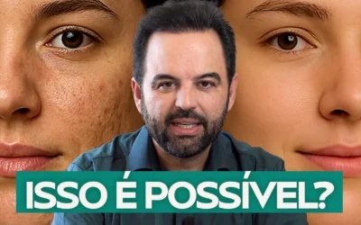 Como tirar marcas da pele? O Guia Médico para tratar Cicatrizes de Acne