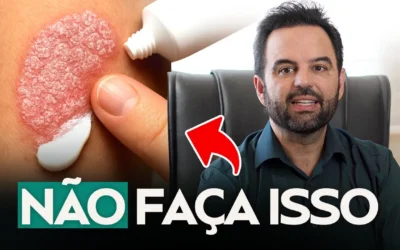 Você está tratando PSORÍASE errado e pode piorar tudo! Entenda como alcançar a remissão